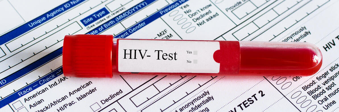 Rotes Blutfläschchen mit Blutprobe über dem Hintergrund des HIV-Testformulars. Blutprobe zur Überprüfung des HIV-Tests.